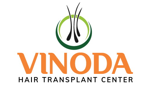 vinoda hair transplant